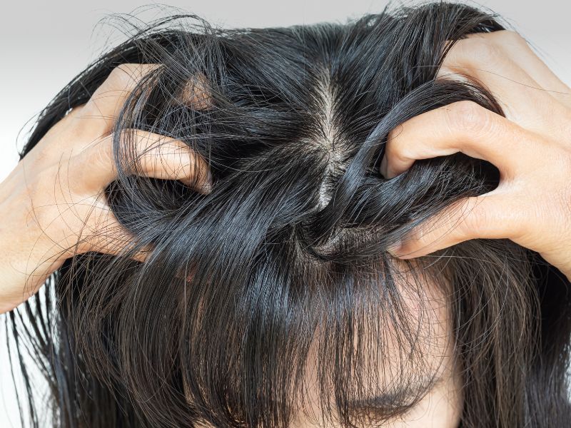 Can Clarifying Shampoo Help With Oily Scalp and Dandruff - K Pure